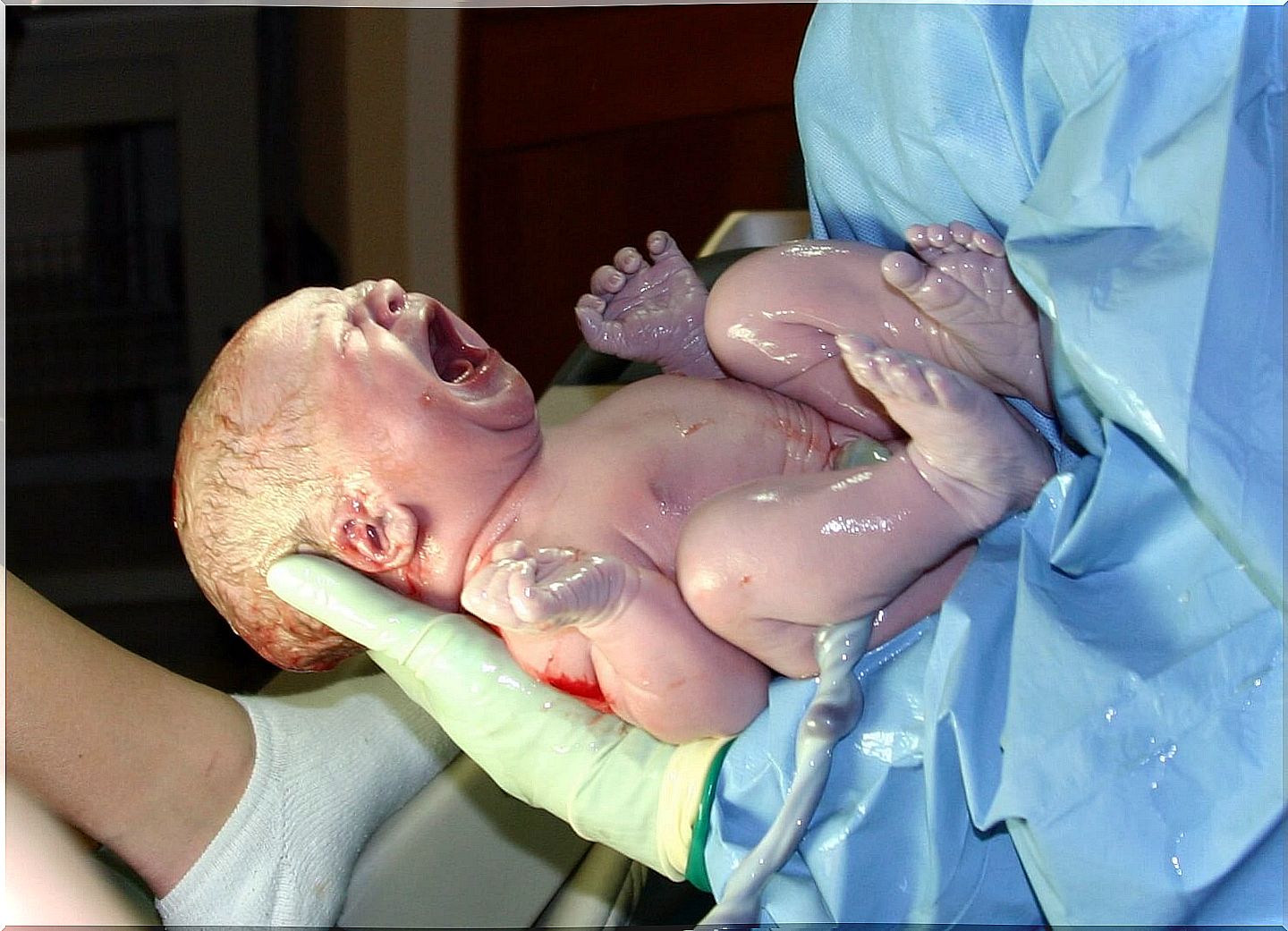 There are 9 types of childbirth, do you know them?