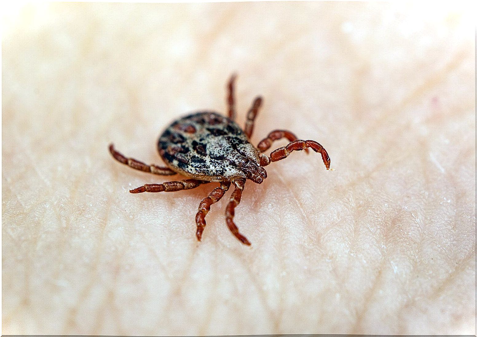 Lyme disease: symptoms, causes, and treatment