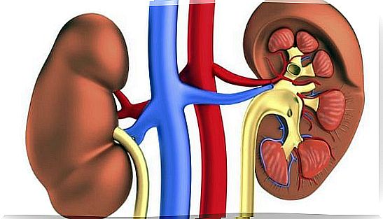 infantile nephritis 3